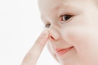 otorrinolaringología infantil, otorrinolaringología pediátrica otorrinolaringología infantil, otorrinolaringología pediátrica